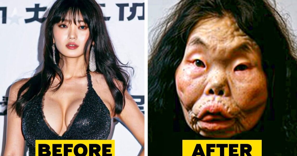 20 Top Celebrity Plastic Surgery Disasters