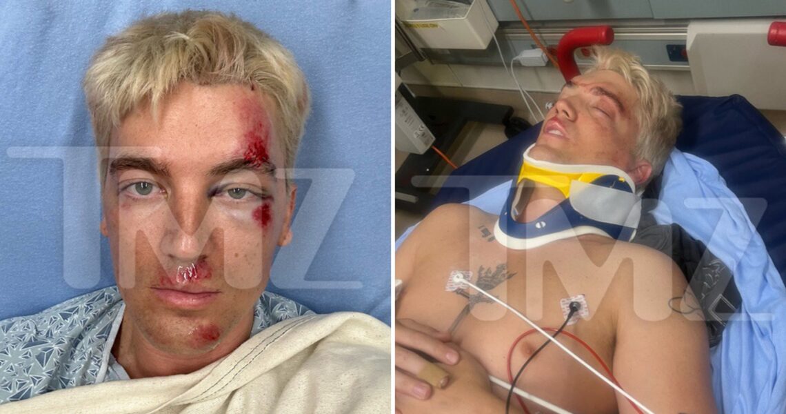 LANY Singer Paul Klein Hit By Car, Posts Pics From Hospital