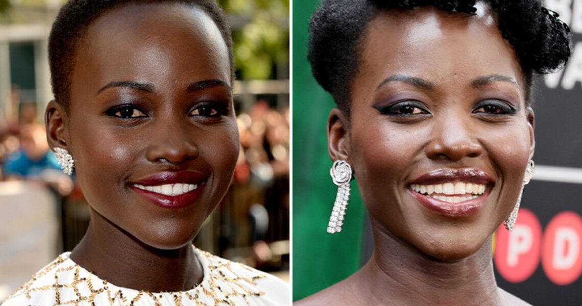 Lupita Nyong’o — Good Genes Or Good Docs?!