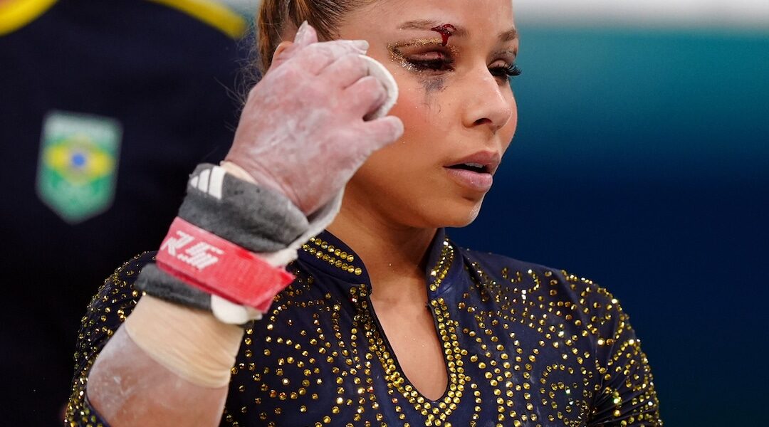 Brazilian Gymnast Flavia Saraiva Competes With Black Eye After Fall