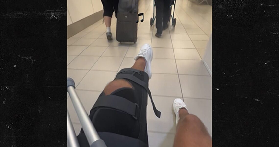 Former ‘Love Island’ Contestant Luca Bish Shows Off Injured Leg