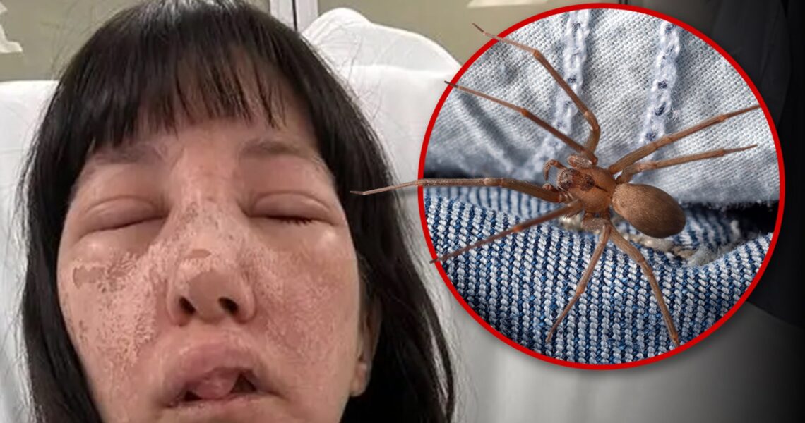 Georgia Woman Suffers Horrible Injuries After Attack from Deadly Spiders