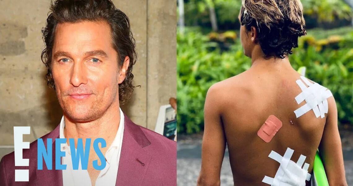 Matthew McConaughey Posts Photo of Son’s Surfing Injury |  E! News