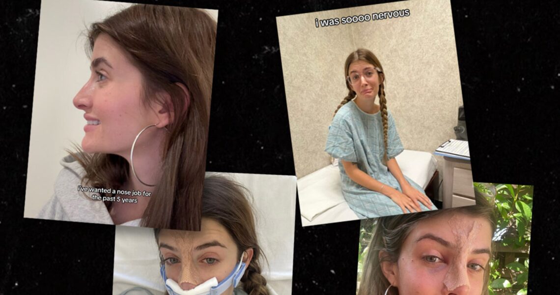 Charlie Sheen’s Daughter Sami Goes Under the Knife for Nose Job