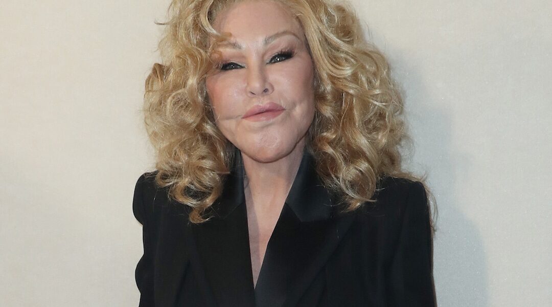 Jocelyn Wildenstein Shares Photo From Before Cosmetic Transformation 