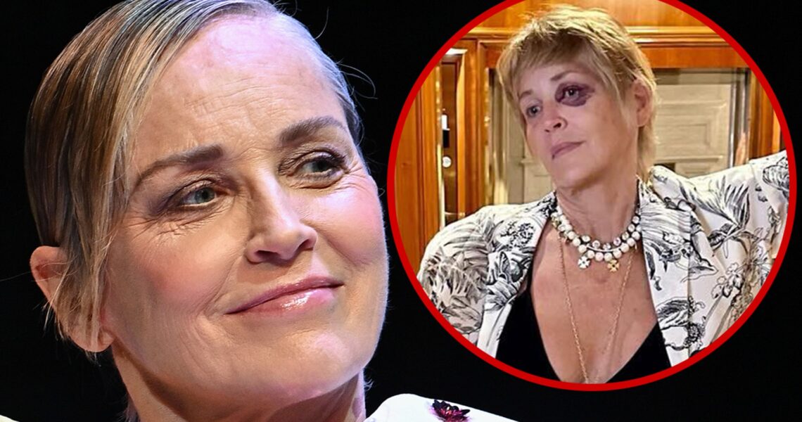 Sharon Stone Shows Off Black Eye During Turkey Vacation