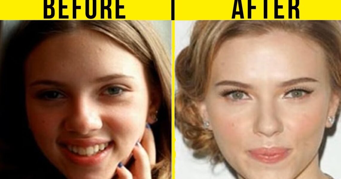 5 Best Celebrity Nose Jobs In Hollywood (Before And After)