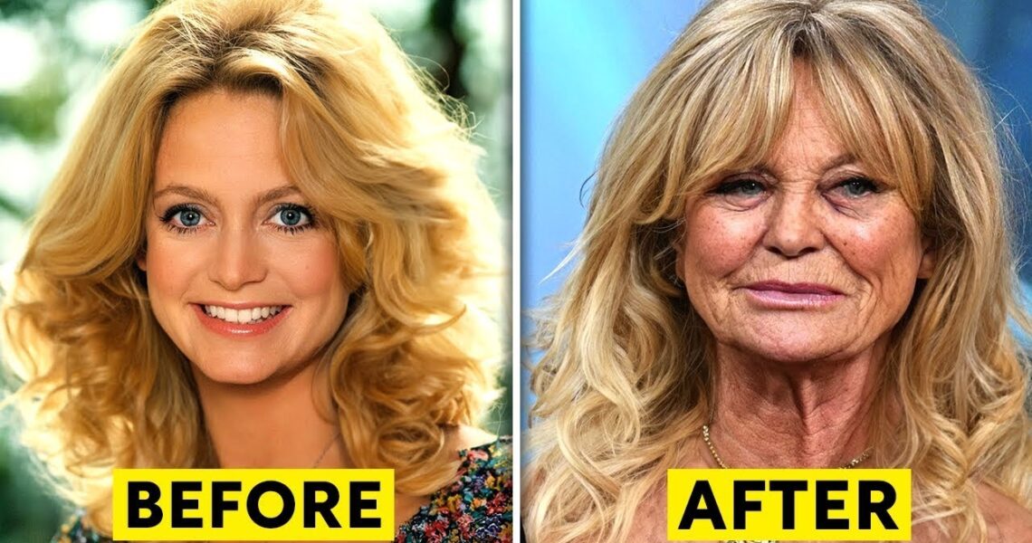 25 Celebrities Who Have Aged Badly