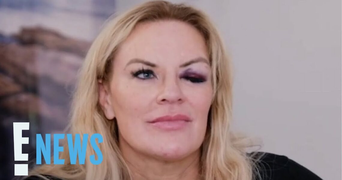 RHOSLC’s Heather Gay Finally Comes Clean About Her Black Eye Mystery | E! News