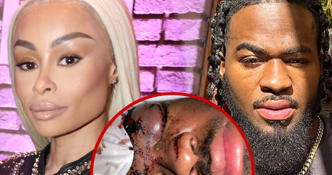 Blac Chyna Sued by Ex-Boyfriend Claiming She Beat Him Up In His Sleep