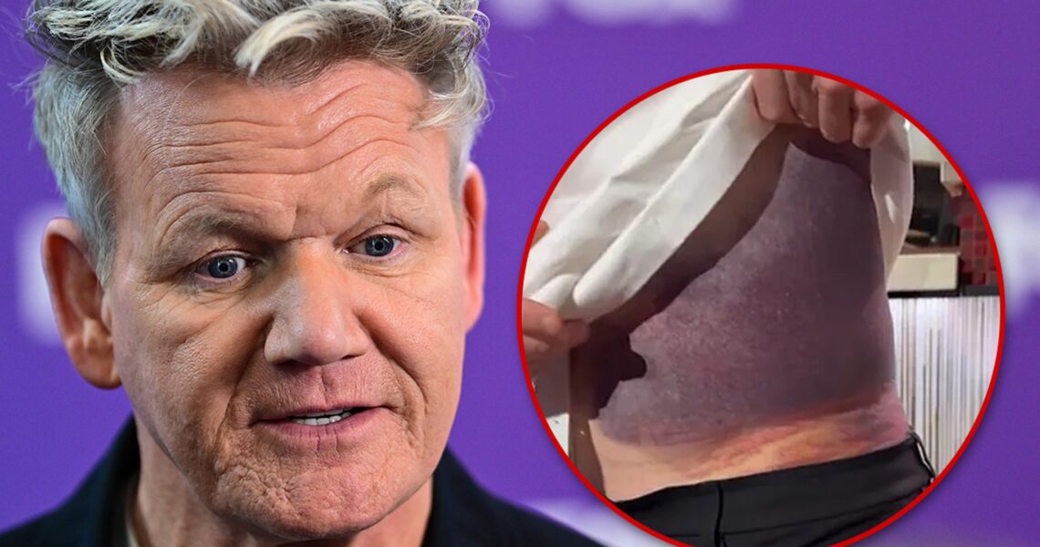 Gordon Ramsay Details Bloody, Painful Aftermath of Bike Crash