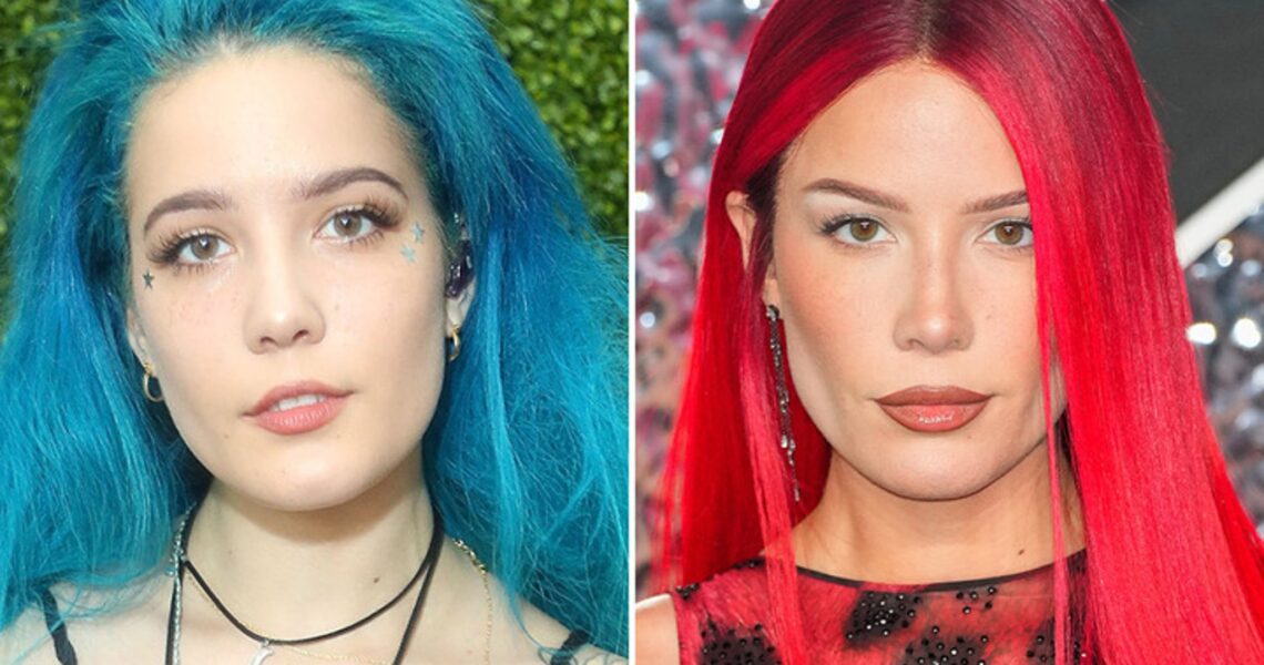 Halsey — Good Genes or Good Docs?!