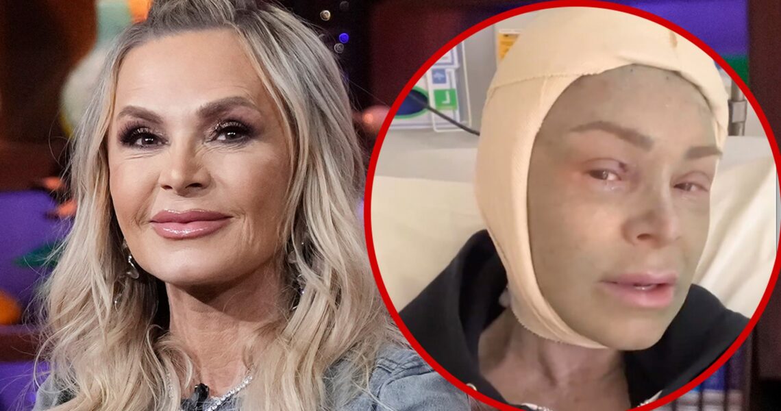 ‘RHOC’ Tamra Judge Documents Brow Lift, Face Peel Post-Op