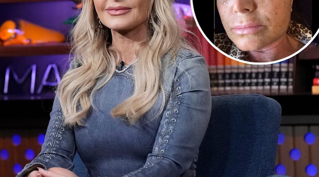 RHOC’s Tamra Judge Looks Unrecognizable After Cosmetic Procedure