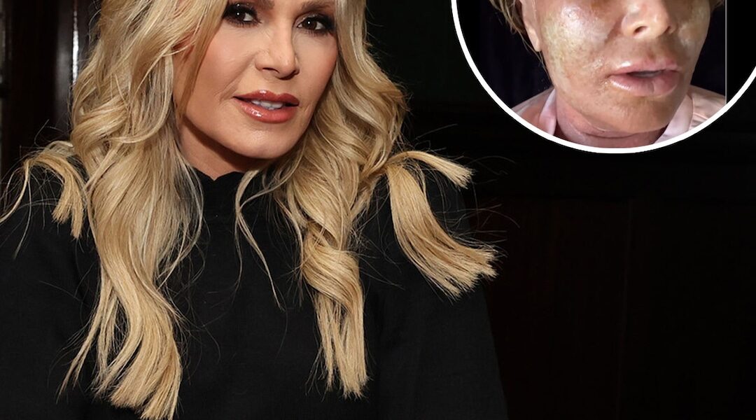 Tamra Judge’s Mom Roasts Her Over Her Post Cosmetic Procedure Look