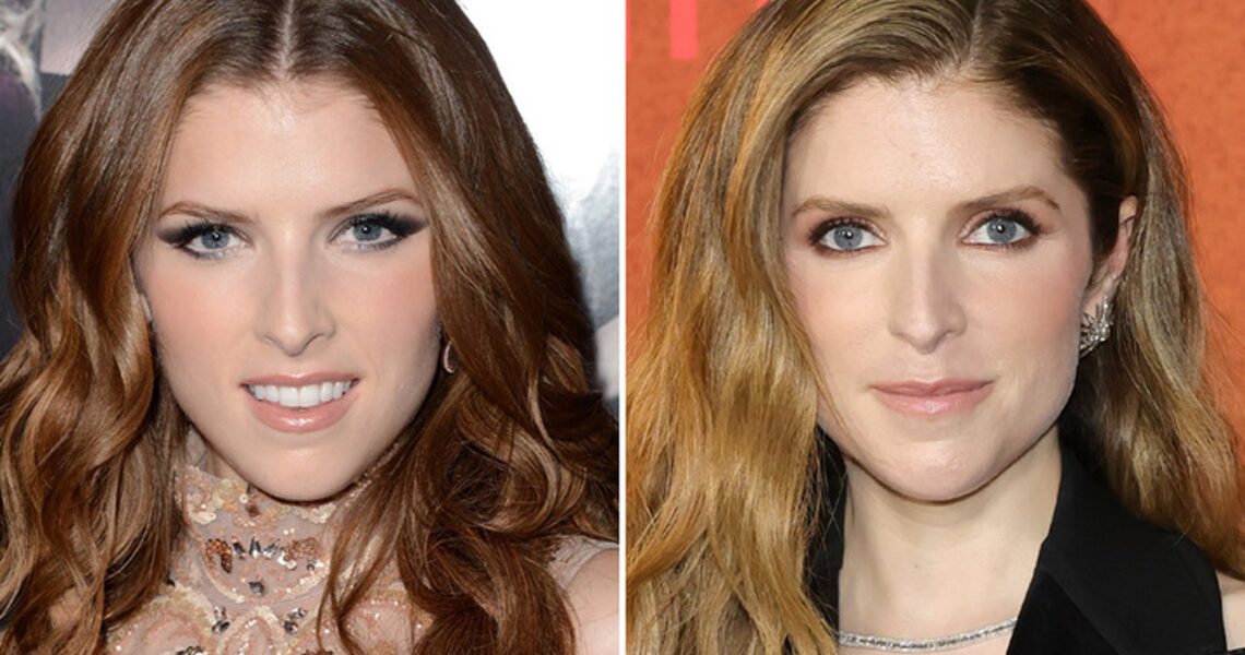 Anna Kendrick — Good Genes or Good Docs?!